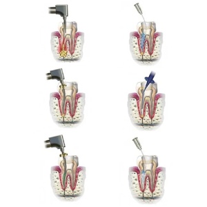 Endo-Prep Crema 2ml Cerkamed