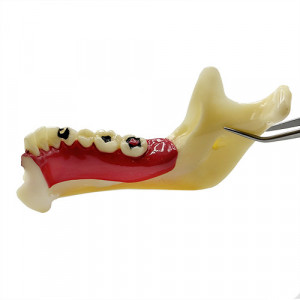 Model educational-mandibula YL-N14