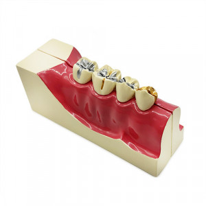 Model educational sectiune mandibula YL-M9