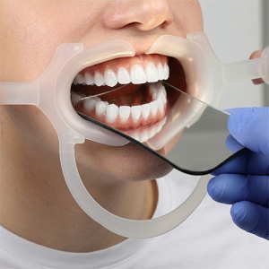 Set Oglinda Fotografie Dentara XL Si Departator Bucal M