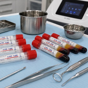 Eprubete A-PRF Vacutainer 10 ml Keymed 10buc - Img 2