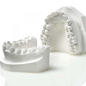Gips Elite Ortho modele ortodontice 3kg