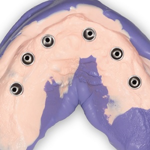 Hydrorise Implant Light Body De 2X50ml Zhermack