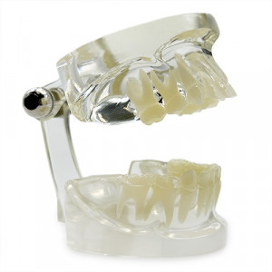 Model pedodontic dinti de lapte transparent YL-C10