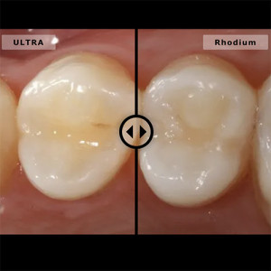 Oglinda cu maner Relax FS diferetnta Ultra si Rhodium