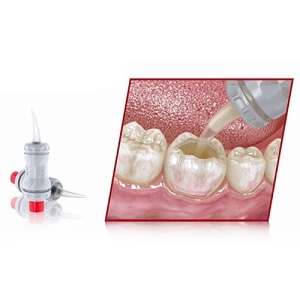 GC Equia Forte HT Fil 50 De Capsule 