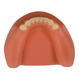 Model Educational Dentar Implant Lateral TM-306