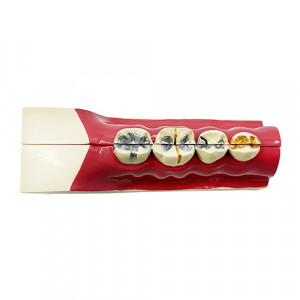 Model dentar educational sectiune mandibula YL-M9