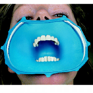 Diga 3D OptiDam anterior introkit kerr