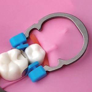 Inel Niti De Fixare Matrici Dentare R2 Small