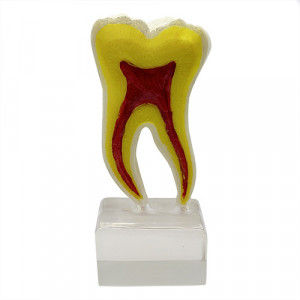Model educational morfologie dentara molar sectionat YL-C20