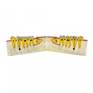 Model educational patologii sectiune mandibula YL-M9