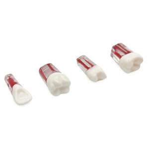 Endo bloc transparent cu coroana YL-N6 1buc