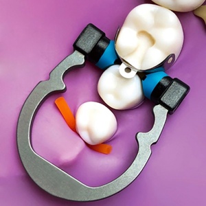 Inel Niti De Fixare Matrici Dentare R5 Small