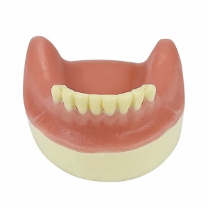 Model Educational Implant Lateral TM-306