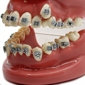 Model educational ortodontic tractiune canin ectopic YL-B1-01