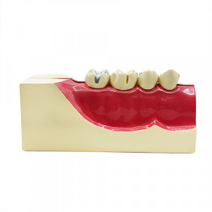 Model educational grup lateral mandibula YL-M9