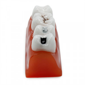 Model educational sigilari dentare YL-M10