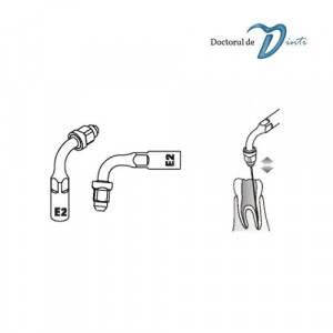 Set anse endodontie EMS/Woodpecker - Img 3
