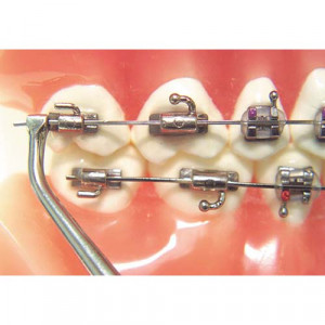 Instrument indoit capatul distal arcuri ortodontice