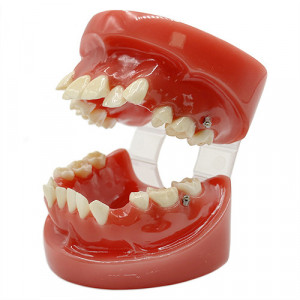 Model educational ortodontic YL-B1