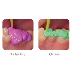 President Set Putty Light Si Extra Light Coltene