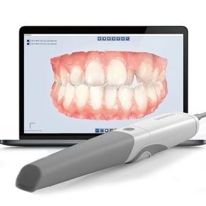 Scanner intraoral Aoralscan 3 Shining 3D - Img 2