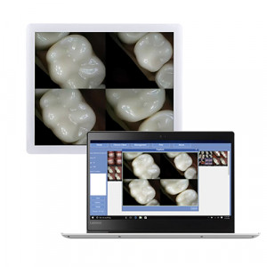 Software camera intraorala monitor HD Wi-Fi