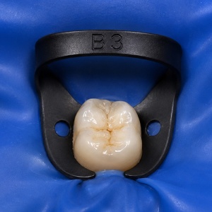 Clema De Diga Brinker B3 Molari Superiori Titanium Black