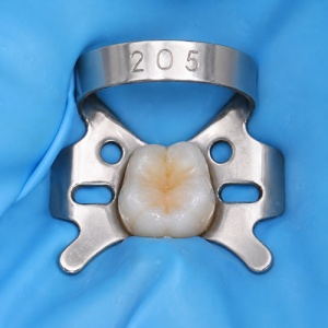Clema De Diga Glossy Nr 205 Molari Superiori
