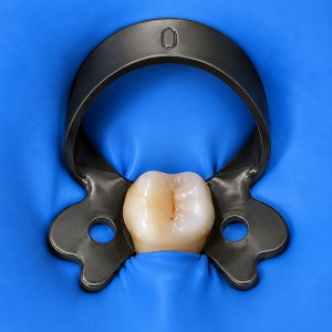 Clema De Diga Premolari #0 Black Coated Cu Aripioare