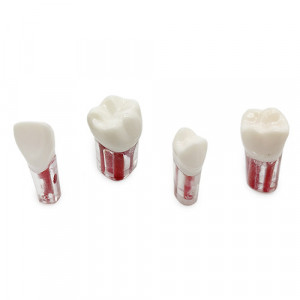 Endobloc transparent cu coroana YL-N6 1buc
