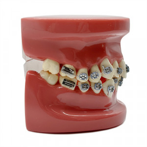 Model educational ortodontic plan lateral YL-B1-01