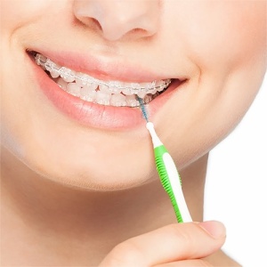 Set periute interdentare color 5 buc VERDE