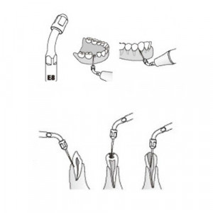 Utilizare ansa endodontie EMS Woodpecker E8