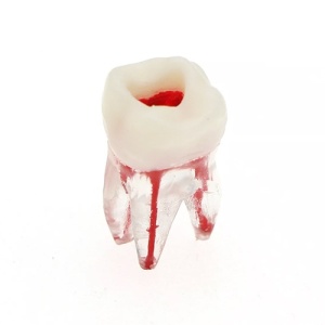 Model Canal Radicular Si Cavitate Pulpar Acces Deschis