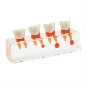 Model educational tratament endodontic