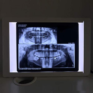 negatoscop medicina dentara