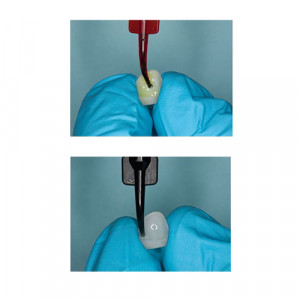 Porcelain Etch si Silan set Ultradent