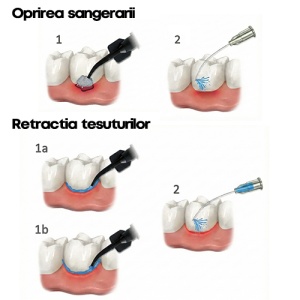 Spuma Hemostatica Alustat Foam De 0.8g Cerkamed