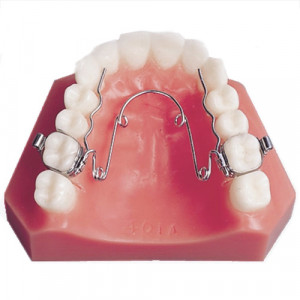 Teaca linguala si quad helix ortodontic