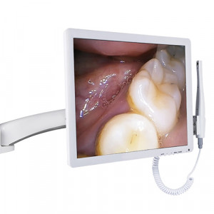 Camera intraorala monitor HD Wi-Fi cu brat