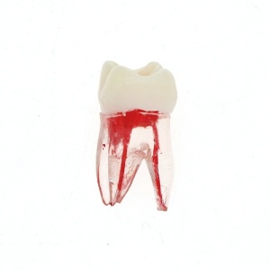 Model De Canal Radicular Si Cavitate Pulpar Acces Deschis