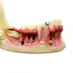 Model dentar - mandibula sectionata YL-N14