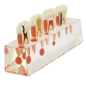 Model educational tratament endo R45