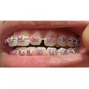 Module elastice color fashion Kitty cat roz 1000buc