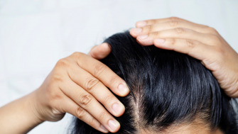 Serul cu Acid Salicilic pentru Păr de la Revox - O soluție revoluționară pentru un scalp sănătos și păr strălucitor