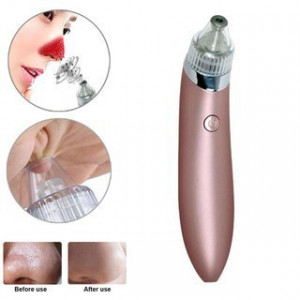 Aparat impotriva punctelor negre,de grasime Vacuum Presure Cleaner,curatare ten,acnee,pori,puncte negre PORKY - Img 1