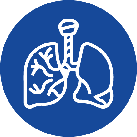 Sferă pulmonară