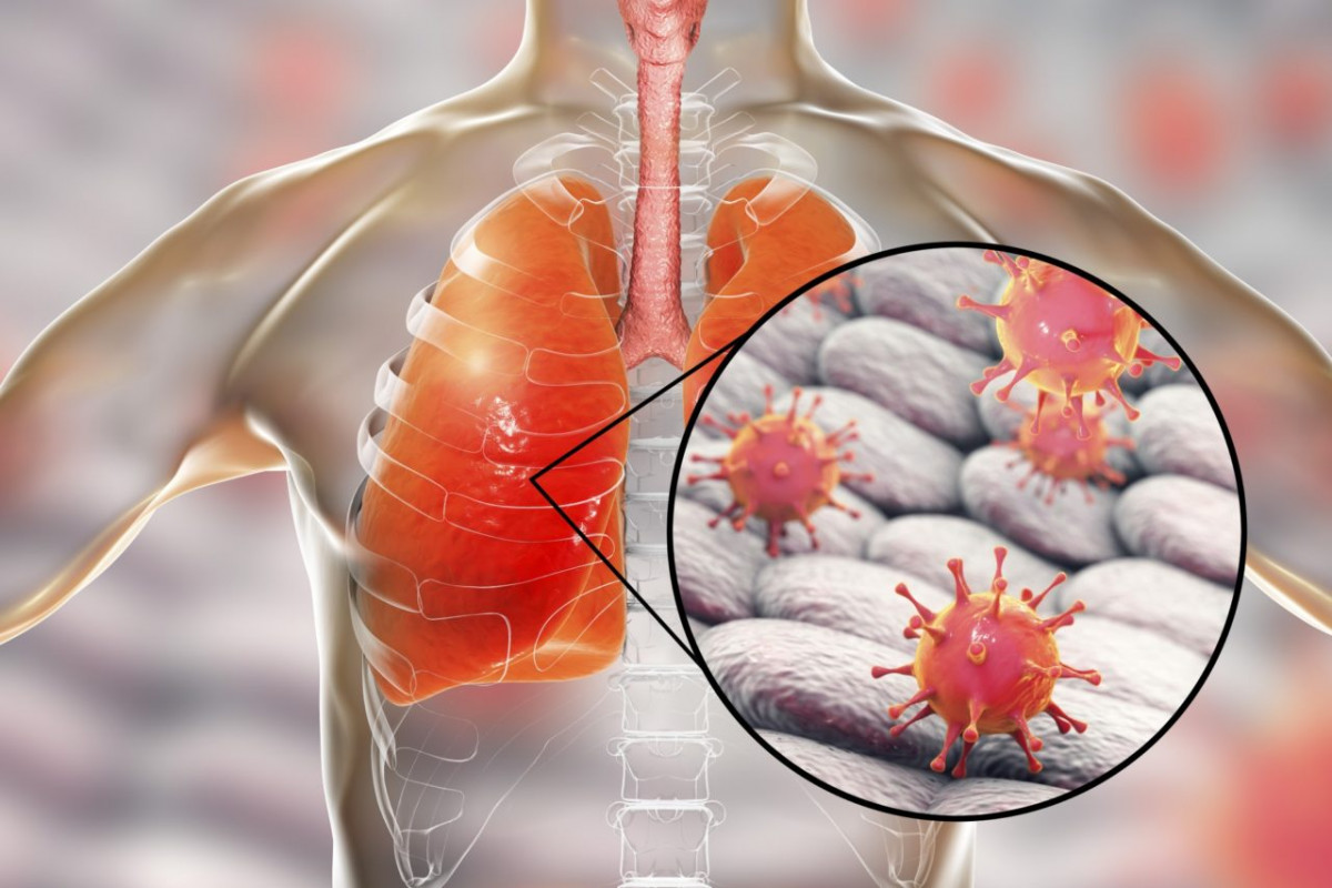 DIFERENȚELE DINTRE METODELE DE TESTARE PENTRU INFECȚIA ACTUALĂ